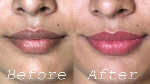 Dark Spot On Lip: How To Make Your Lips Pink?