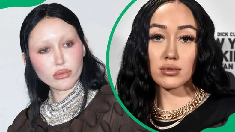 Why Does Noah Cyrus Not Have Eyebrows?